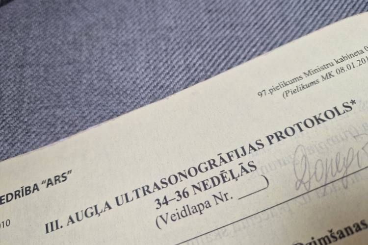 34.grūtniecības nedēļa